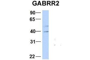 Host:  Rabbit  Target Name:  GABRR2  Sample Type:  Human Fetal Brain  Antibody Dilution:  1.
