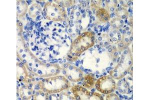 Immunohistochemistry of paraffin-embedded Rat kidney using DCTD Polyclonal Antibody at dilution of 1:200 (40x lens). (DCMP Deaminase (DCTD) anticorps)