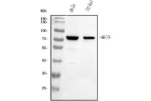 Western blot analysis of MAVS using anti-MAVS antibody (ABIN7603227).
