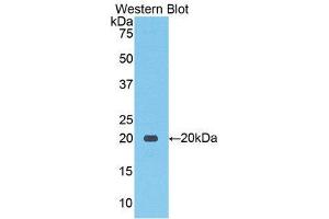 Western Blotting (WB) image for anti-Solute Carrier Family 12 (Sodium/Chloride Transporters), Member 3 (SLC12A3) (AA 867-1024) antibody (ABIN1859969) (SLC12A3 anticorps  (AA 867-1024))