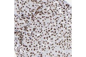 Immunohistochemical staining of human liver with ZNF544 polyclonal antibody  shows strong nuclear positivity in hepatocytes and bile duct cells .