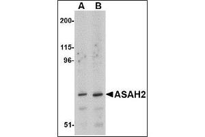 Western blot analysis of ASAH2 in 293 cell lysate with ASAH2 antibody at (A) 1 and (B) 2 µg/ml. (ASAH2 anticorps  (C-Term))