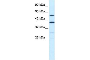 WB Suggested Anti-DXYS155E Antibody Titration:  0.