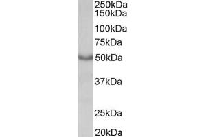 Western Blotting (WB) image for anti-Muscarinic Acetylcholine Receptor M1 (CHRM1) antibody (ABIN5924735) (CHRM1 anticorps)