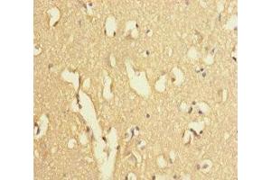 Immunohistochemistry of paraffin-embedded human brain tissue using ABIN7174279 at dilution of 1:100 (USP2 anticorps  (C-Term))