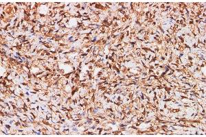 Immunohistochemistry of paraffin-embedded Human ovary using S100A11 Polyclonal Antibody at dilution of 1:200 (S100A11 anticorps)