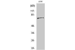Western Blotting (WB) image for anti-BMX Non-Receptor Tyrosine Kinase (BMX) (Ser182) antibody (ABIN3183533) (BMX anticorps  (Ser182))