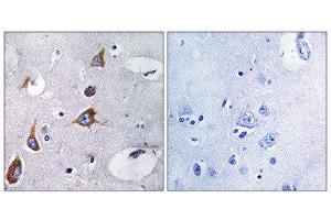 Immunohistochemistry (IHC) image for anti-Chondroitin Sulfate Synthase 1 (CHSY1) (Internal Region) antibody (ABIN1851106) (CHSY1 anticorps  (Internal Region))