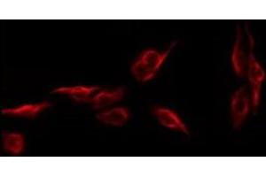 ABIN6279501 staining CoLo by IF/ICC. (NKX6-1 anticorps  (Internal Region))