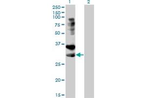 Western Blot analysis of TNFRSF14 expression in transfected 293T cell line by TNFRSF14 monoclonal antibody (M01), clone 2G6-2C7. (HVEM anticorps  (AA 38-283))