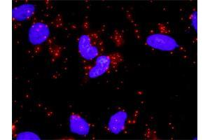 Proximity Ligation Analysis of protein-protein interactions between NFKB1 and STAT3.