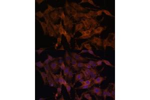 Immunofluorescence analysis of HeLa cells using TLR3 antibody (ABIN6130066, ABIN6149219, ABIN6149220 and ABIN6215465) at dilution of 1:100.