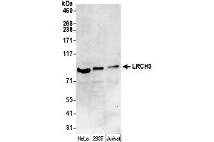 anti-Leucine-Rich Repeats and Calponin Homology (CH) Domain Containing 3 (LRCH3) (AA 500-550) antibody