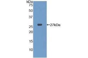 Detection of Recombinant PFKP, Human using Polyclonal Antibody to Phosphofructokinase, Platelet (PFKP)