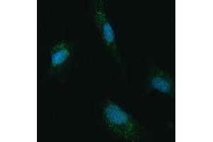 IF analysis of UBC12/UBE2M using anti-UBC12/UBE2M antibody (ABIN7600885). (UBE2M anticorps  (AA 25-154))