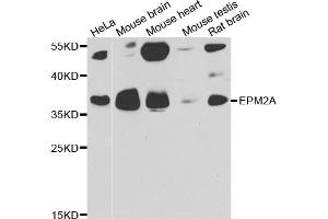 Western blot analysis of extracts of various cell lines, using EPM2A antibody (ABIN5974214) at 1/1000 dilution. (EPM2A anticorps)