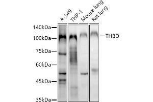 Western blot analysis of extracts of various cell lines, using THBD antibody (ABIN1683026, ABIN3018621, ABIN3018622 and ABIN6220518) at 1:1000 dilution.