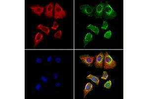 ABIN6262069 and ABIN6276964 staining Hela cells by IF/ICC. (GPX4 anticorps  (C-Term))
