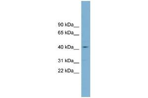 WB Suggested Anti-ZDHHC18  Antibody Titration: 0.