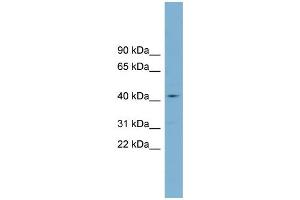 WB Suggested Anti-ZDHHC18  Antibody Titration: 0. (ZDHHC18 anticorps  (Middle Region))