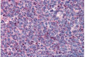 Human Tonsil: Formalin-Fixed, Paraffin-Embedded (FFPE)