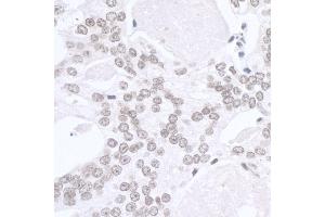 Immunohistochemistry (IHC) image for anti-SWI/SNF Related, Matrix Associated, Actin Dependent Regulator of Chromatin, Subfamily A, Member 1 (SMARCA1) (AA 1004-1054) antibody (ABIN7448799)