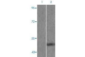 Western blot analysis of Lane 1: mouse brain tissue lysate preincubated with blocking peptide, Lane 2: mouse brain tissue lysate without blocking peptide by MAPT (phospho S262) polyclonal antibody  at 1:500-1:1000 dilution.