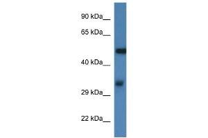 WB Suggested Anti-Fscn1 Antibody   Titration: 1. (Fascin anticorps  (N-Term))