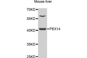 Western blot analysis of extracts of mouse liver, using PEX3 antibody. (PEX3 anticorps)