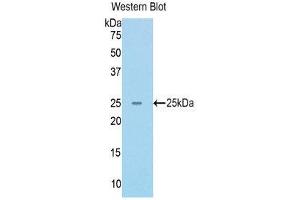 Western Blotting (WB) image for anti-RAD50 Homolog (S. Cerevisiae) (RAD50) (AA 400-595) antibody (ABIN1176803) (RAD50 anticorps  (AA 400-595))