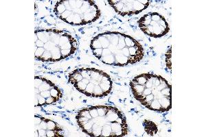 Immunohistochemistry of paraffin-embedded mouse pancreas using SOX9 Rabbit pAb (ABIN1682861, ABIN5664083, ABIN5664085 and ABIN6219552) at dilution of 1:100 (40x lens).