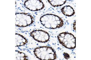 Immunohistochemistry of paraffin-embedded mouse pancreas using SOX9 Rabbit pAb (ABIN1682861, ABIN5664083, ABIN5664085 and ABIN6219552) at dilution of 1:100 (40x lens). (SOX9 anticorps  (AA 100-200))