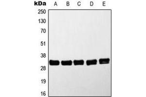 Western blot analysis of MYD88 expression in HeLa (A), Jurkat (B), K562 (C), Raji (D), Molt4 (E) whole cell lysates. (MYD88 anticorps  (Center))
