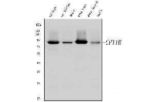 Western blot analysis of CPT1B using anti-CPT1B antibody (ABIN3042757). (CPT1B anticorps  (N-Term))