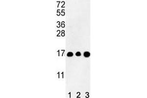 Western blot analysis of HIST3H3 antibody and (1) CEM, (2) K562, and (3) HL-60 lysate (Histone Cluster 3, H3 (HIST3H3) (AA 1-30) anticorps)