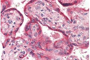 Human Placenta (formalin-fixed, paraffin-embedded) stained with OPN3 antibody ABIN399999 at 5 ug/ml followed by biotinylated goat anti-rabbit IgG secondary antibody ABIN481713, alkaline phosphatase-streptavidin and chromogen.