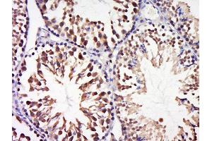 Paraformaldehyde-fixed, paraffin embedded mouse testis tissue, Antigen retrieval by boiling in sodium citrate buffer(pH6) for 15min, Block endogenous peroxidase by 3% hydrogen peroxide for 30 minutes, Blocking buffer (normal goat serum) at 37°C for 20min, Antibody incubation with Rabbit Anti-CCDC58 Polyclonal Antibody, Unconjugated  at 1:500 overnight at 4°C, followed by a conjugated secondary and DAB staining
