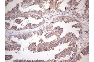 Immunohistochemistry (IHC) image for anti-Amelotin (AMTN) antibody (ABIN2716039)