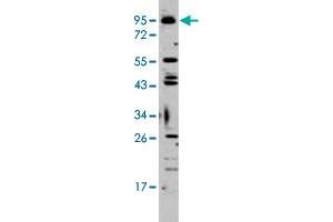 Western blot analysis of K-562 cell lysate (35 ug/lane) with Tlr6 polyclonal antibody . (TLR6 anticorps  (C-Term))