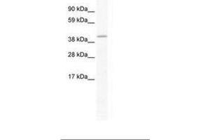 Image no. 1 for anti-GATA Binding Protein 5 (GATA5) (AA 321-370) antibody (ABIN202438) (GATA5 anticorps  (AA 321-370))