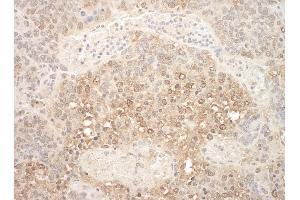 Immunohistochemistry (IHC) image for anti-Anaphase Promoting Complex Subunit 7 (ANAPC7) (AA 515-565) antibody (ABIN7448413) (ANAPC7 anticorps  (AA 515-565))