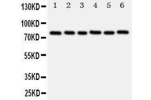 Anti-B MyB antibody, Western blotting Lane 1: Rat Spleen Tissue Lysate Lane 2: Rat Thymus Tissue Lysate Lane 3: Rat Brain Tissue Lysate Lane 4: HELA Cell Lysate Lane 5: COLO320 Cell Lysate Lane 6: MCF-7 Cell Lysate (MYBL2 anticorps  (N-Term))