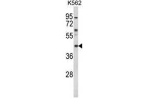 Western blot analysis of MC3R Antibody (Center) in K562 cell line lysates (35ug/lane). (MC3R anticorps  (Middle Region))