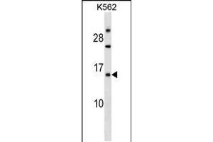 Western blot analysis in K562 cell line lysates (35ug/lane). (EMP1 anticorps  (N-Term))