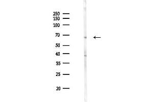 Western blot analysis of lysates from Mouse brain, using PADI4 Antibody at 1/1000 dilution.