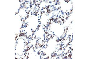 Immunohistochemistry of paraffin-embedded rat lung using ERp29 Rabbit mAb (ABIN7266943) at dilution of 1:100 (40x lens). (ERP29 anticorps)