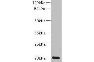 Western blot All lanes: ZMAT5 antibody at 5 μg/mL + Colo320 whole cell lysate Secondary Goat polyclonal to rabbit IgG at 1/10000 dilution Predicted band size: 20 kDa Observed band size: 20 kDa