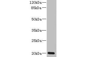 Western blot All lanes: ZMAT5 antibody at 5 μg/mL + Colo320 whole cell lysate Secondary Goat polyclonal to rabbit IgG at 1/10000 dilution Predicted band size: 20 kDa Observed band size: 20 kDa (ZMAT5 anticorps  (AA 1-170))