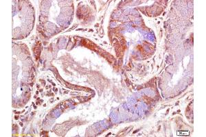 Formalin-fixed and paraffin embedded human skin labeled with Rabbit Anti JNK2 Polyclonal Antibody, Unconjugated (ABIN681403) at 1:200 followed by conjugation to the secondary antibody and DAB staining (JNK1/2 anticorps  (AA 311-424))