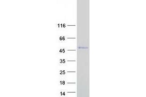 Validation with Western Blot